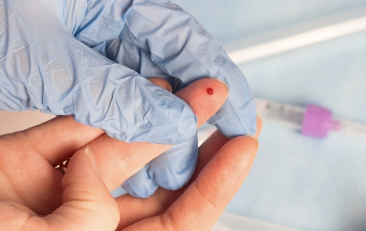 HIV TEST