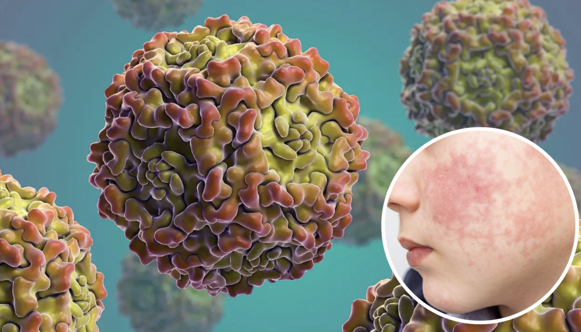 Brote de parvovirus en Harris: vacunan gratis a perros 2025