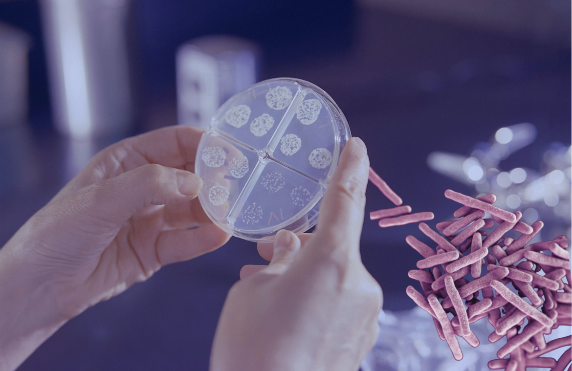 2 casos de tuberculosis en Houston generan alerta (2025)